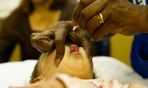 Read more about the article Mais de 60% das crianças ainda não foram vacinadas contra a pólio