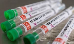Read more about the article Anvisa recebe pedido de registro para teste de varíola dos macacos